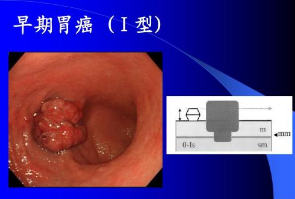 水污染与癌症高发区必备这款仪器